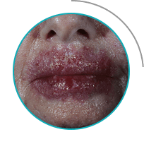 Milozol